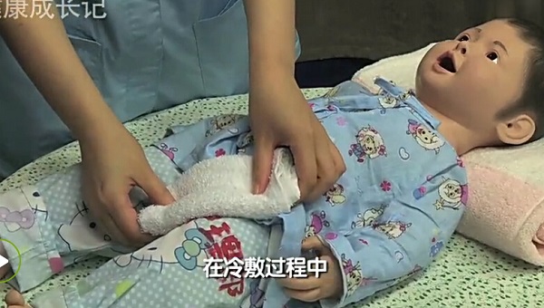 冷敷法发烧降温